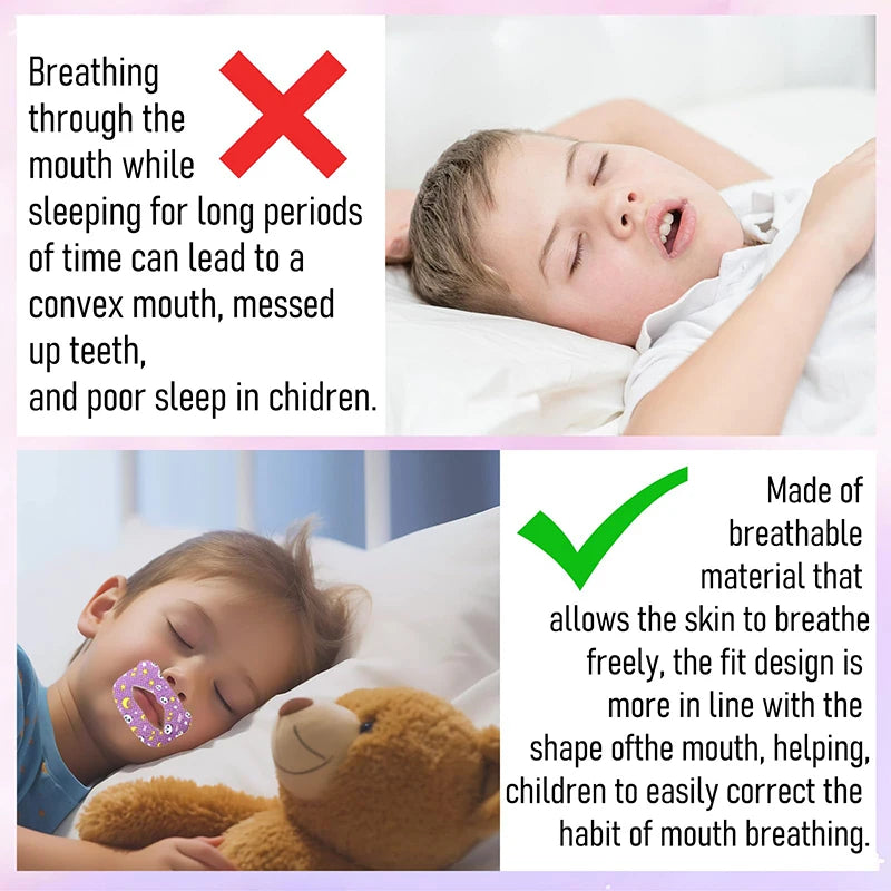 > Kids Anti-Snoring Sleep Strips – 30 Pcs Gentle Mouth Tape for Kids Nasal Breathing & Better Sleep