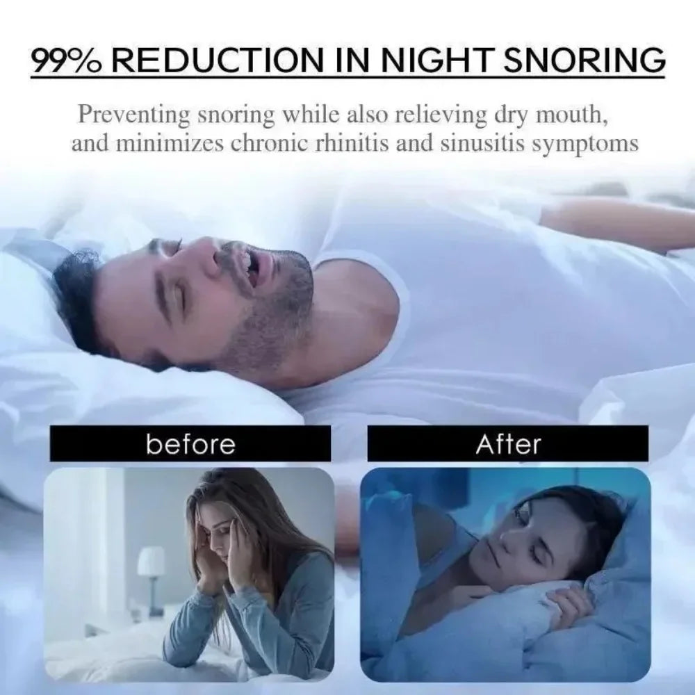 30 Pcs Anti-Snoring Mouth Tape – Breathable Elastic Sleep Strips for Nasal Breathing & Snoring Relief